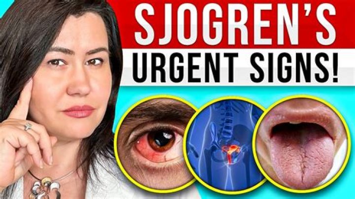 Can you cry with Sjogren's?