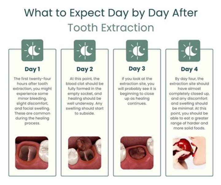 Can you request to be put to sleep for tooth extraction?