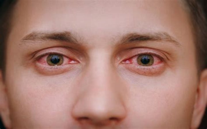 Can you tell if someone is mentally ill by their eyes?