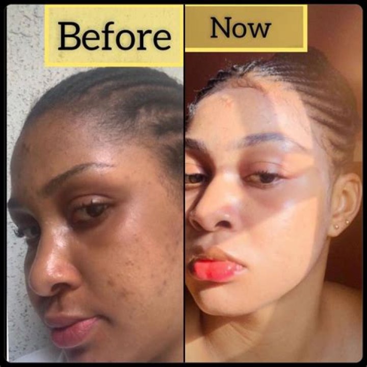 Does baobab powder lighten skin?