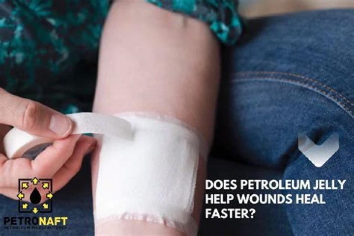 Does petroleum jelly help hemorrhoids?