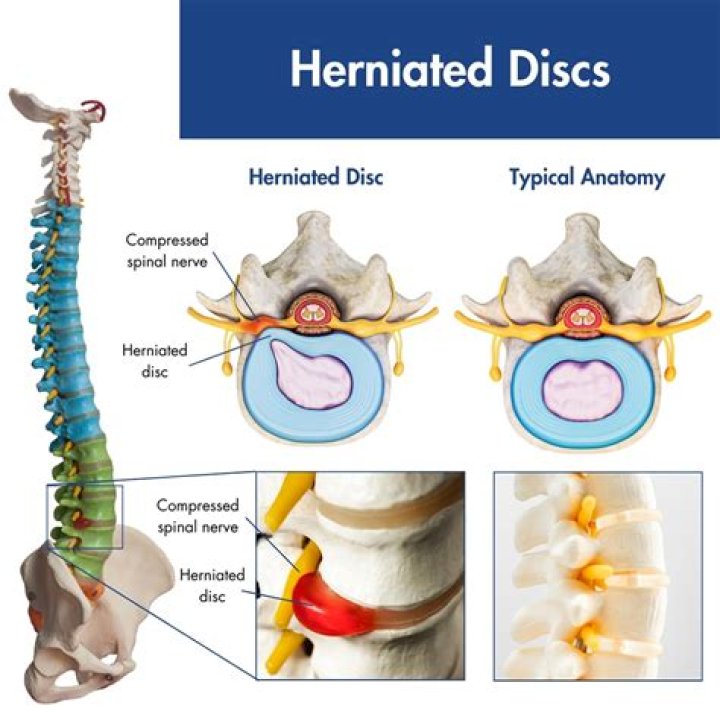 Does Sifu have a disc?