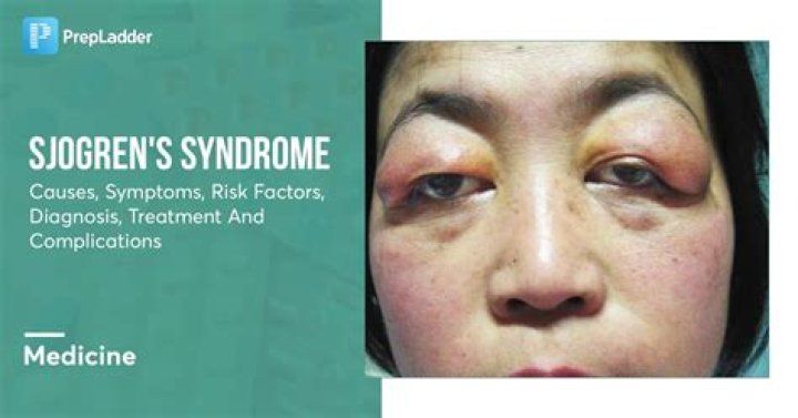 Does Sjogren's affect the nose?