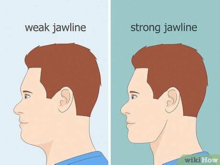 What causes weak jawline?