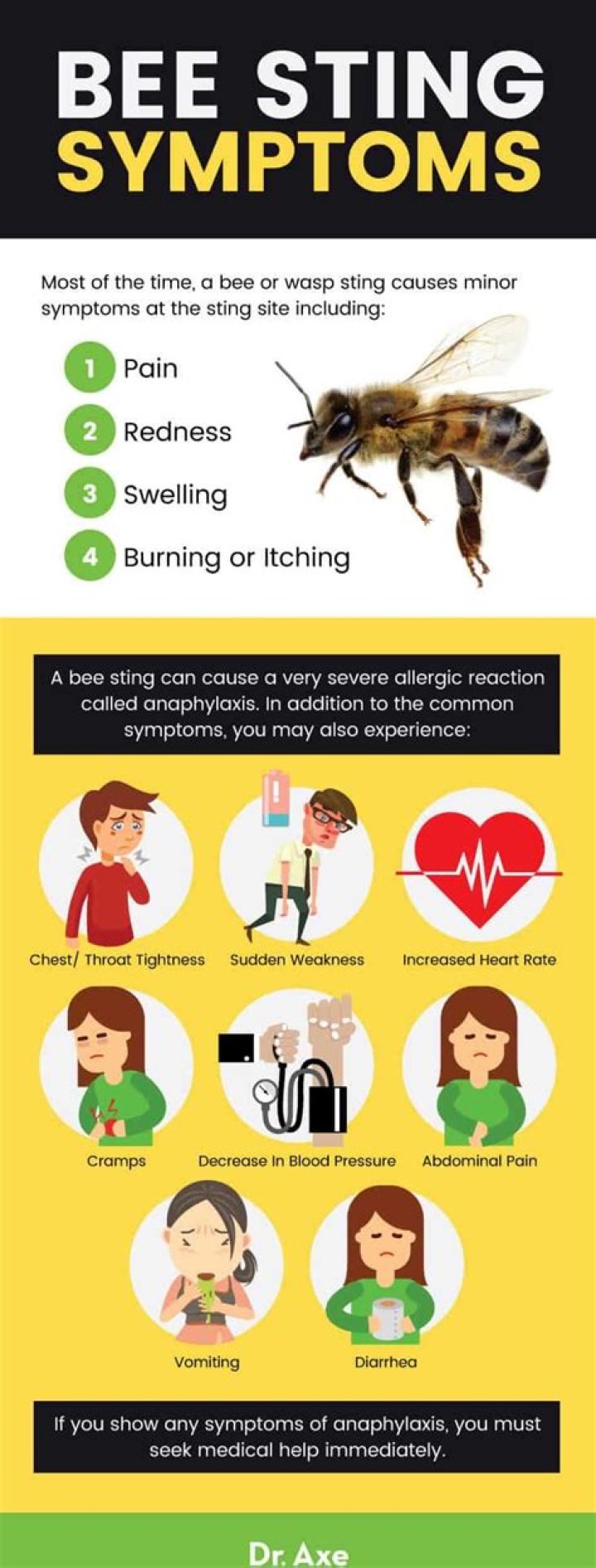 What happens when you get stung by a bee and you are allergic?