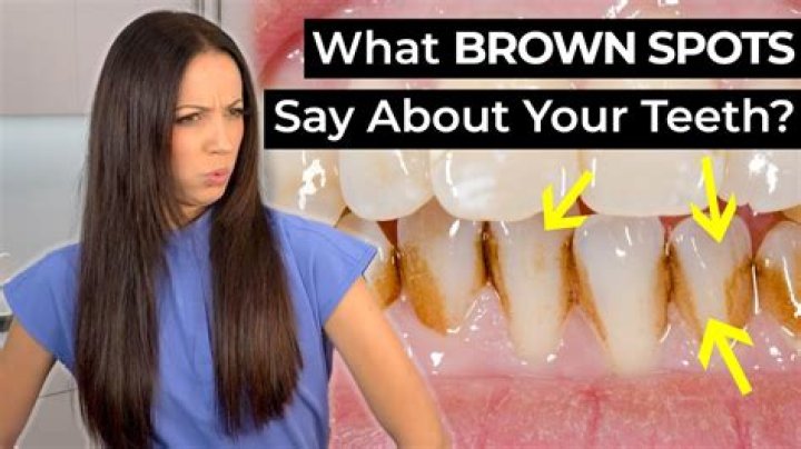 Why do I wake up with brown stuff on my teeth?