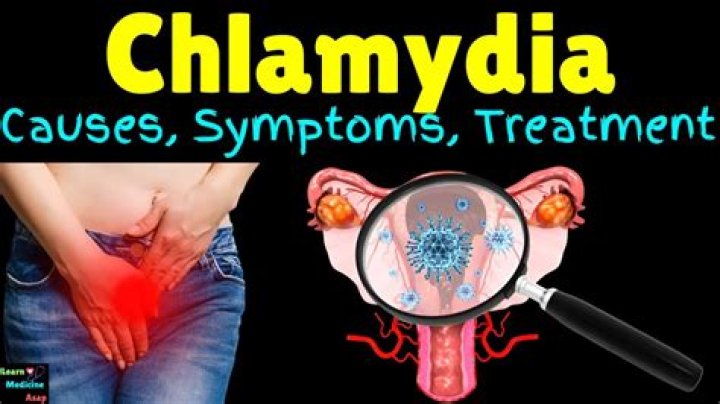 Why won't my chlamydia go away?