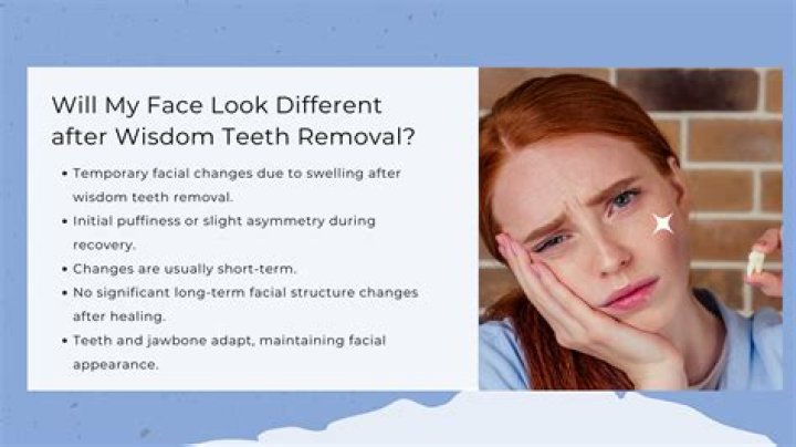 Will you tell secrets after getting wisdom teeth out?